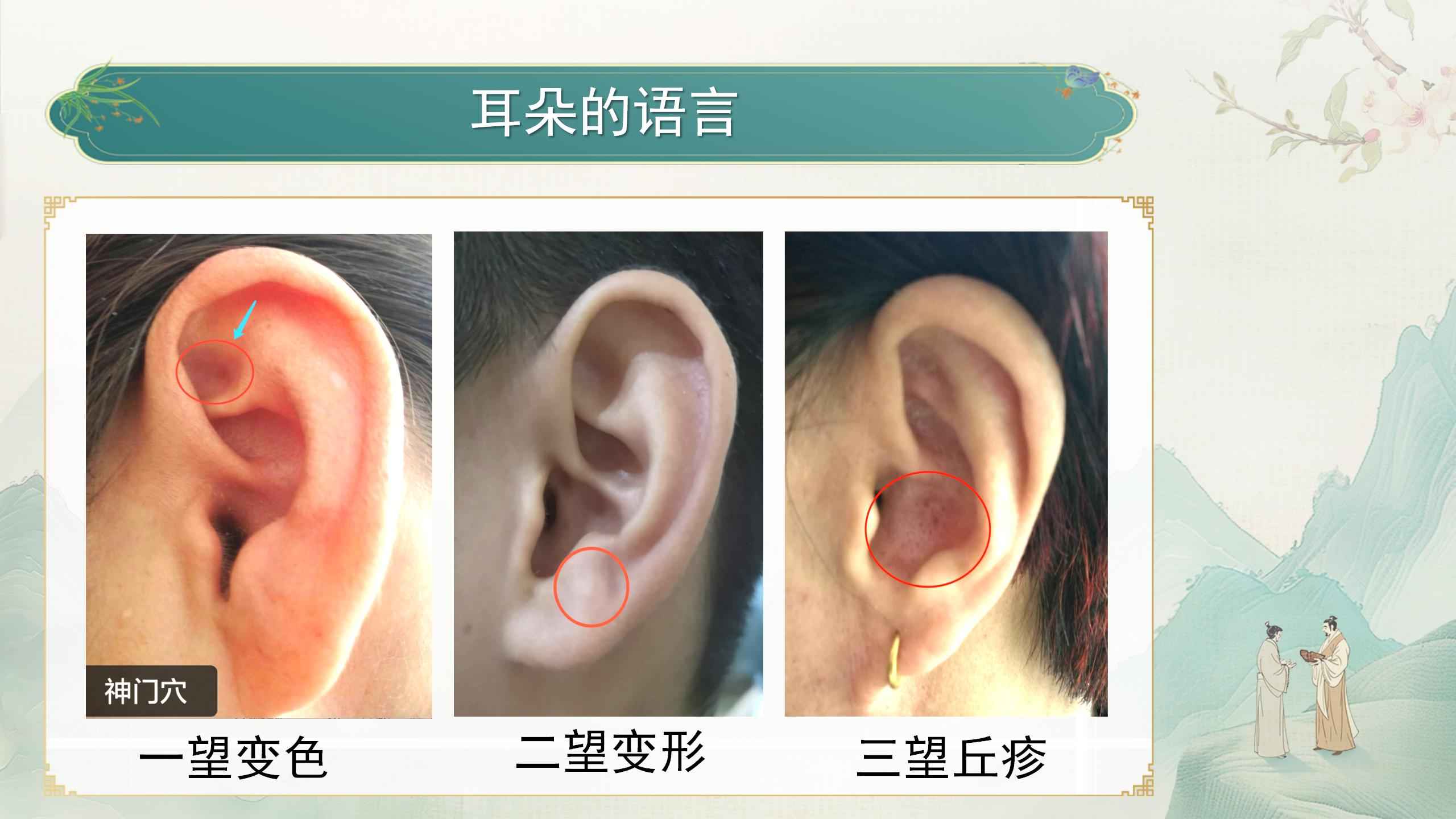 250412elcy40.jpg 250412elcy40.jpg